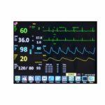 Virgo 12.1” Patient Monitor - Patient Monitor