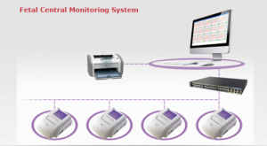 Fetal Central Monitoring System - Fetal Monitor