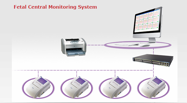 Fetal Central Monitoring System - Fetal Monitor